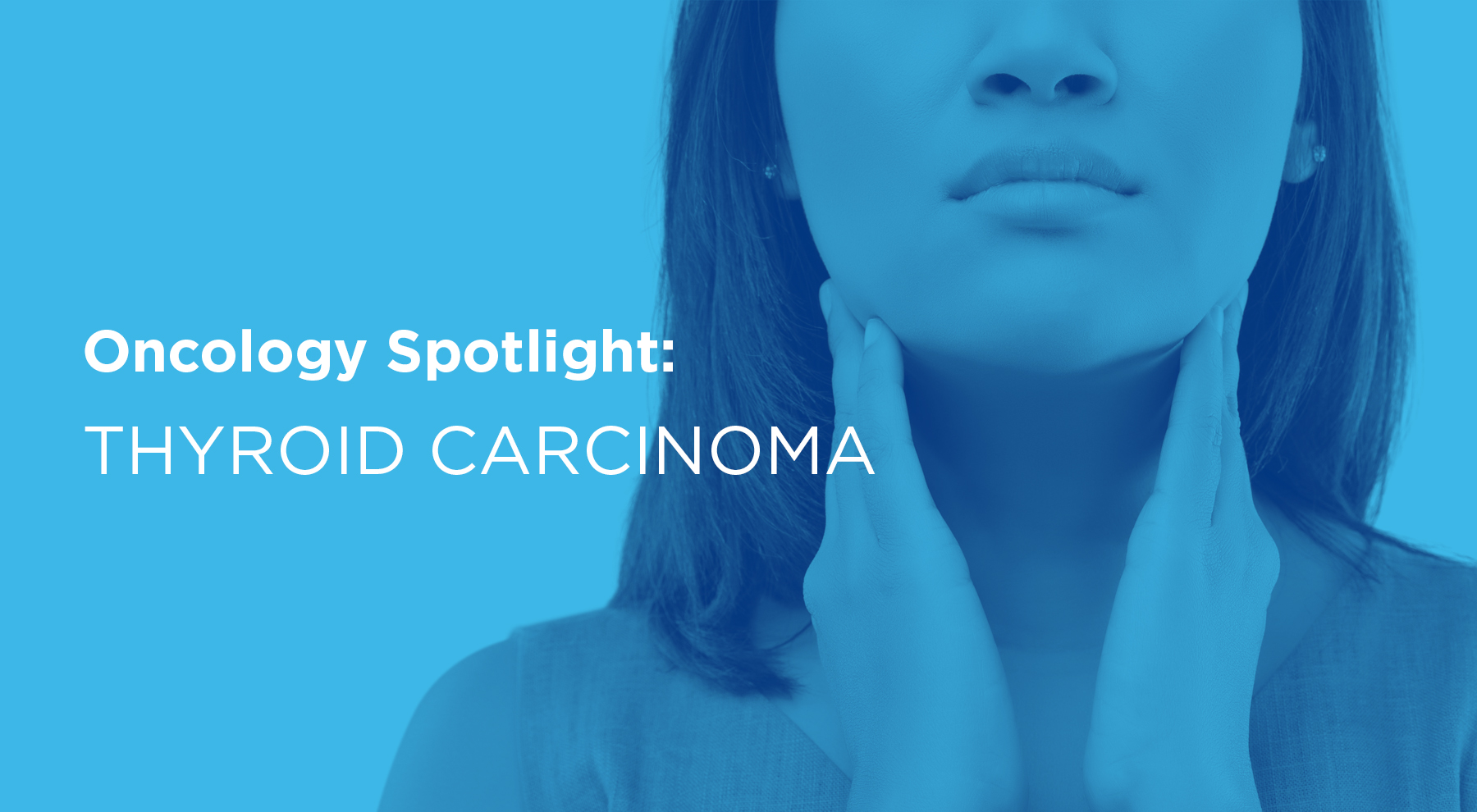 Image of patient touching their neck. Overlayed text says Oncology Spotlight: Thyroid Carinoma.